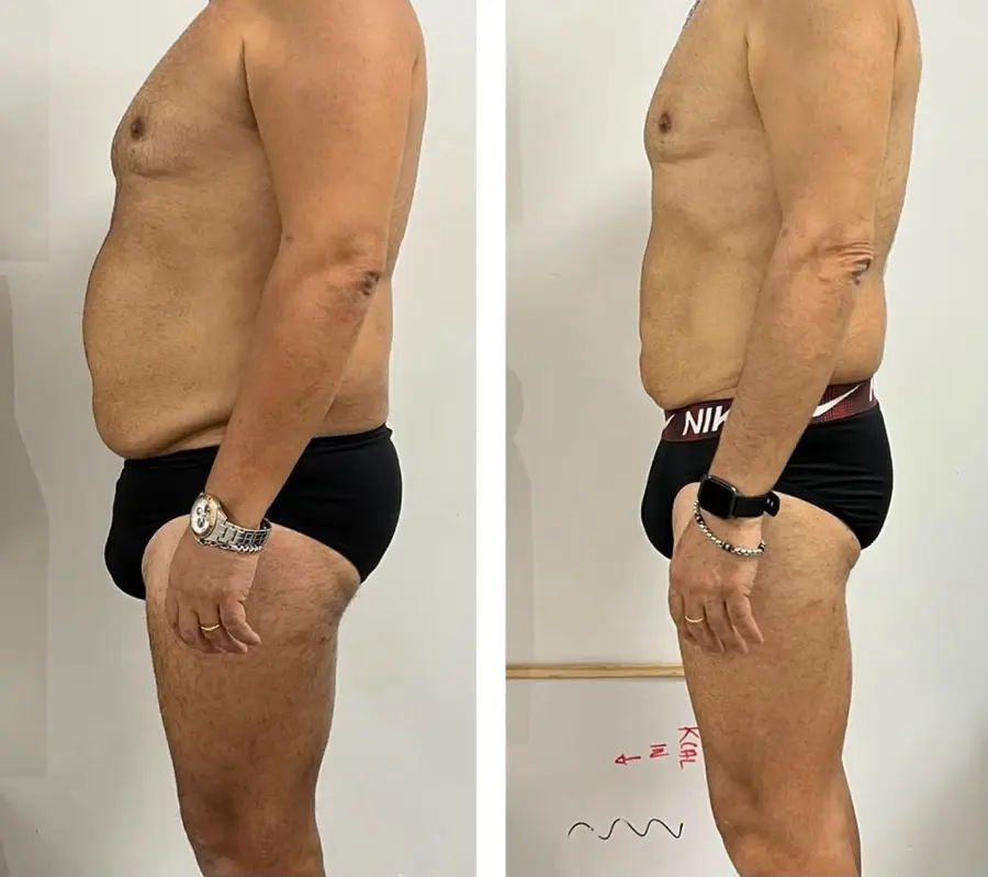 Foto prima e dopo il percorso di una persona seguita (3)